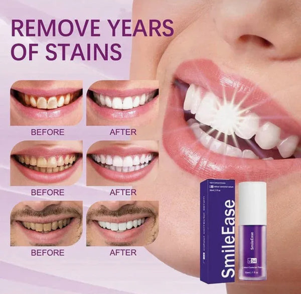 Hismile v34 Color Corrector Purple Teeth Whitening Toothpaste Kit without Toothbrush Pen Strips