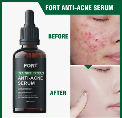FORT Salicylic Acid Serum – Anti-Acne Face Serum & Dark Spot Correcting Serum for Glowing Skin