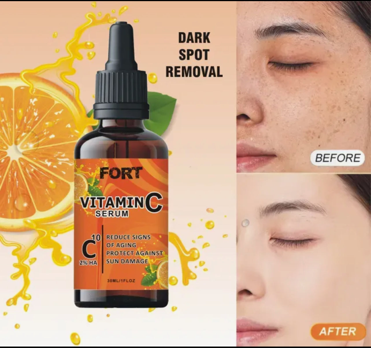 FORT Vitamin C Serum for Face - Anti-Aging, Dark Spot Correcting, and Whitening